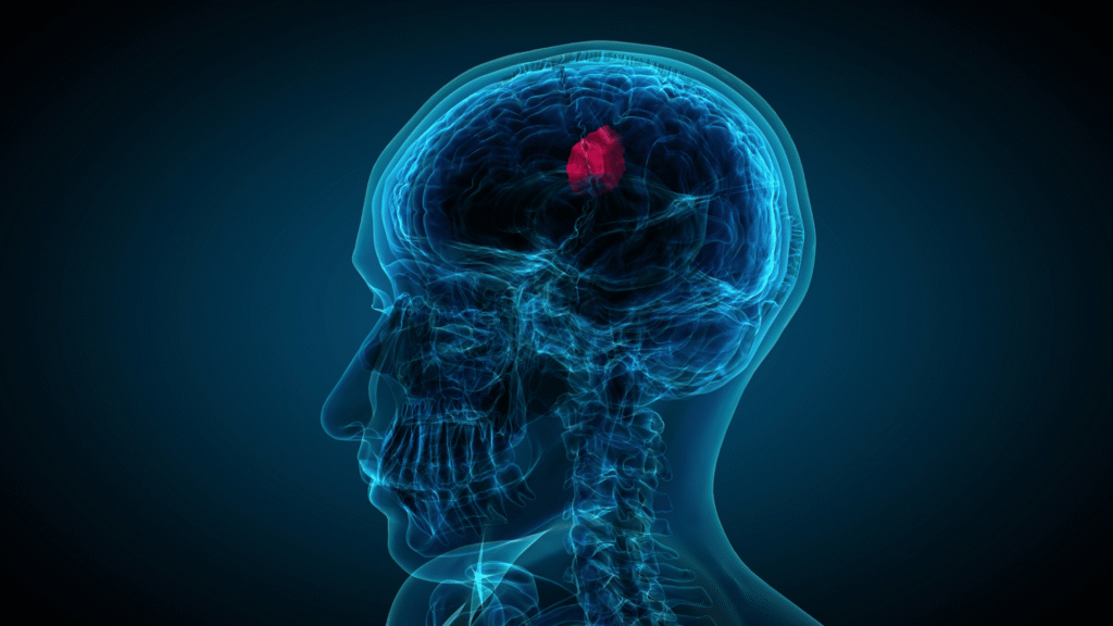 AI Brain Fry by Norm Murray - The Norm Report
